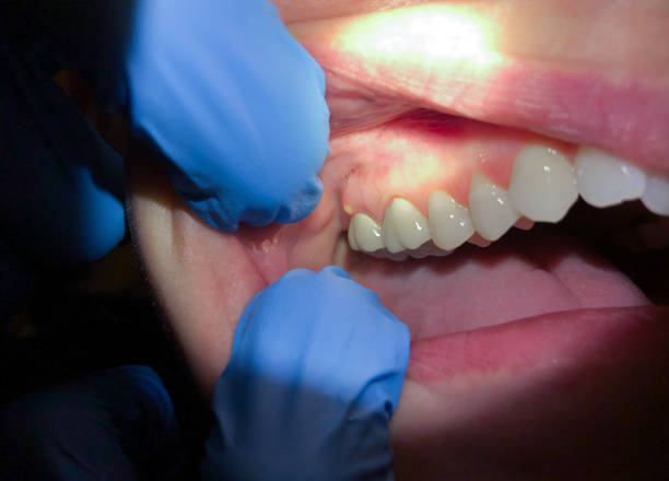 Best After-Hours Emergency Dentist in Arrowhead Beach, NC