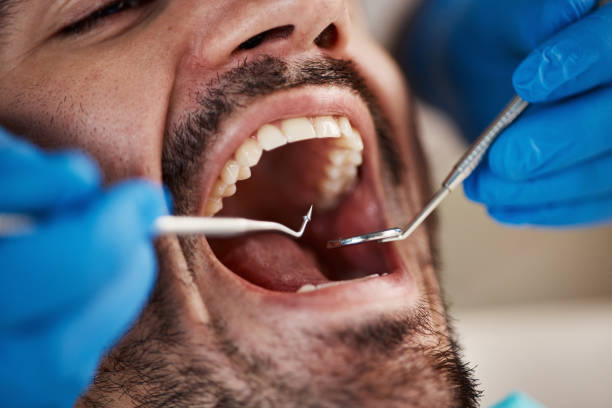 Best Walk-In Emergency Dentist in Arrowhead Beach, NC